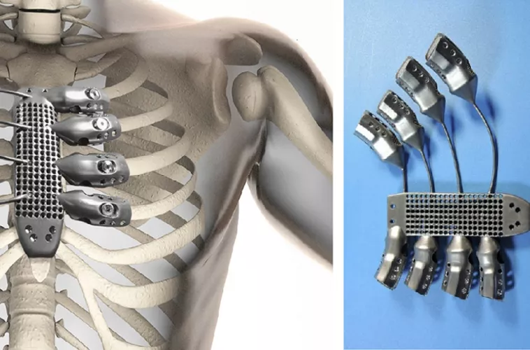 cnc machining parts of medical